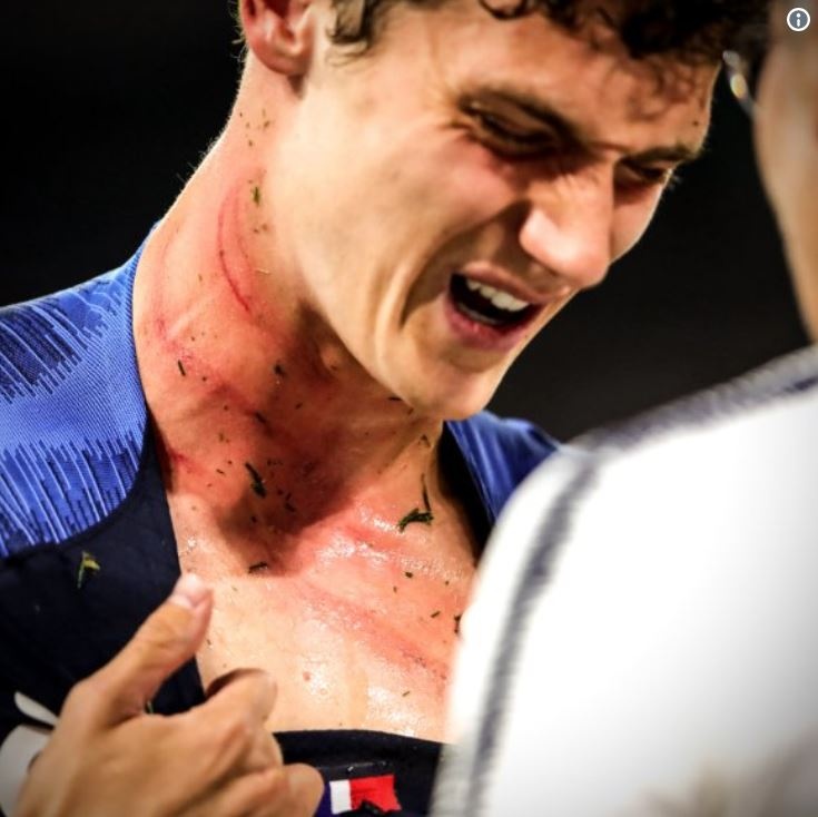Rudiger giẫm lên cổ PAvard ảnh 3 Rudiger giam len co PAvard anh 3