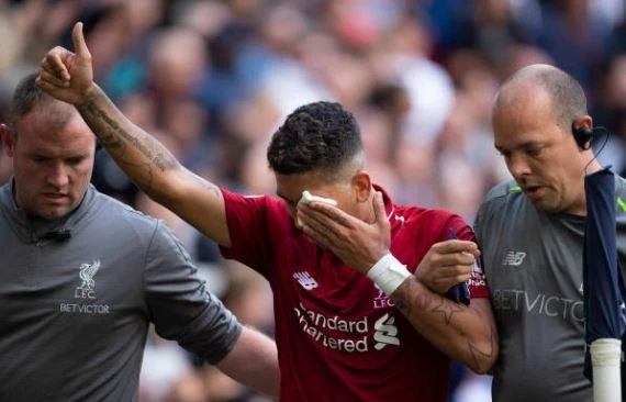 pha choc mat kinh di cua Vertonghen voi Firmino anh 4