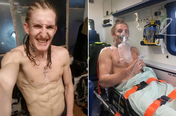 HLV MMA bi dam 2 nhat khi chong lai 8 ten cuop co dao hinh anh