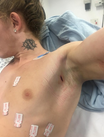 HLV MMA chống lại 8 tên cướp ảnh 1 HLV MMA chong lai 8 ten cuop anh 1