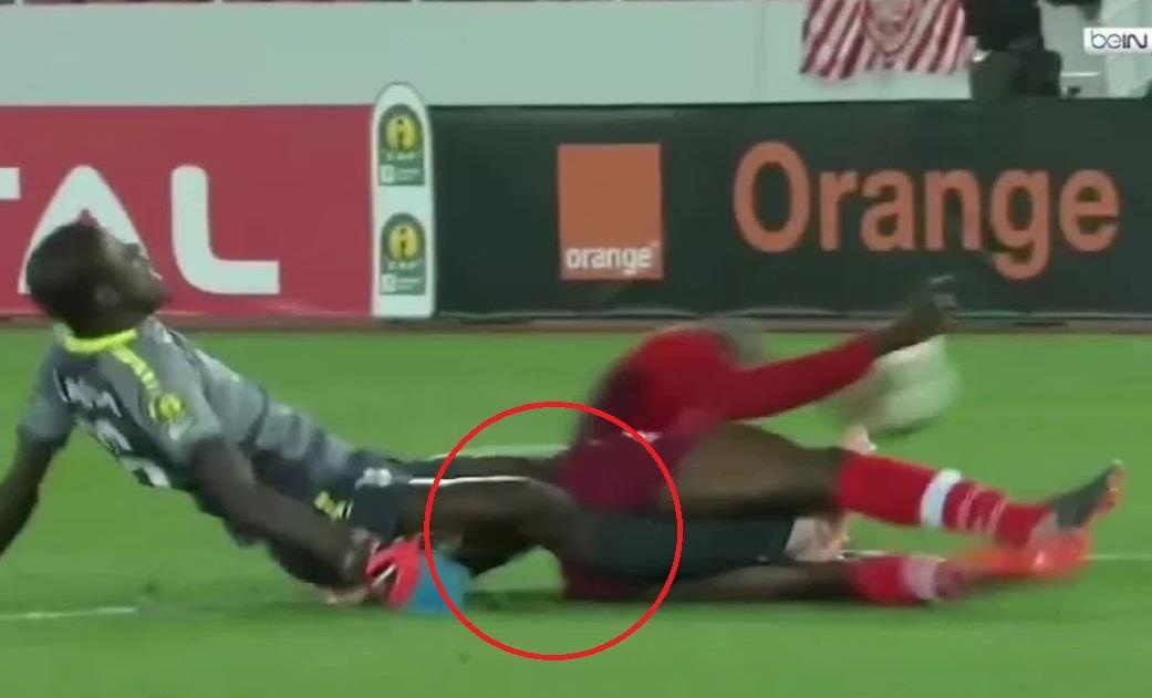 thu mon gay chan o cup chau Phi anh 1