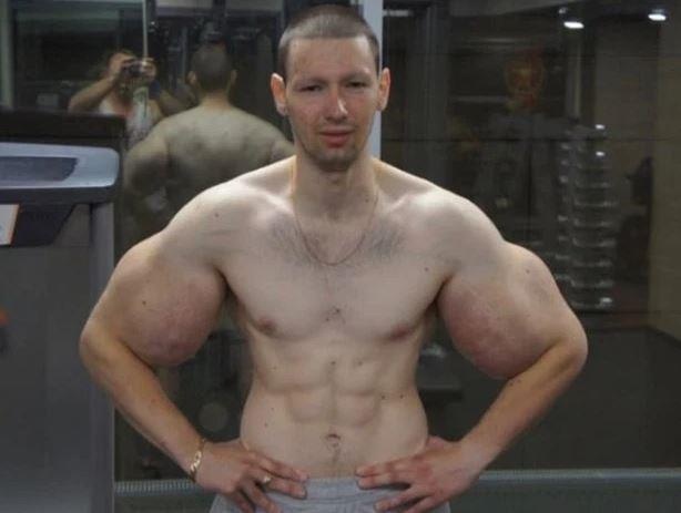 Chang trai tiem dau vao co bap anh 1