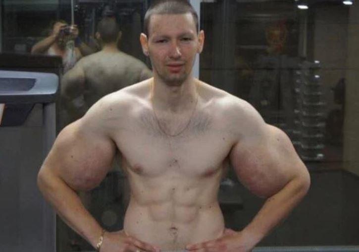 Chang trai tiem dau vao co bap cau cuu vi nhiem trung hinh anh