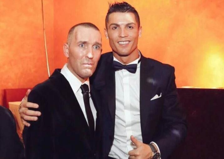 Cuu tien ve Ha Lan qua doi vi benh hiem gap hinh anh