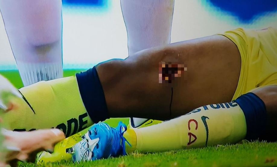 Cuu sao Barca chan thuong kinh hoang anh 1