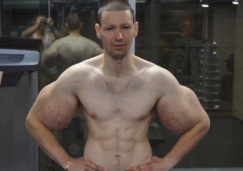 Vo si MMA rut hoa chat khoi bap tay hinh anh