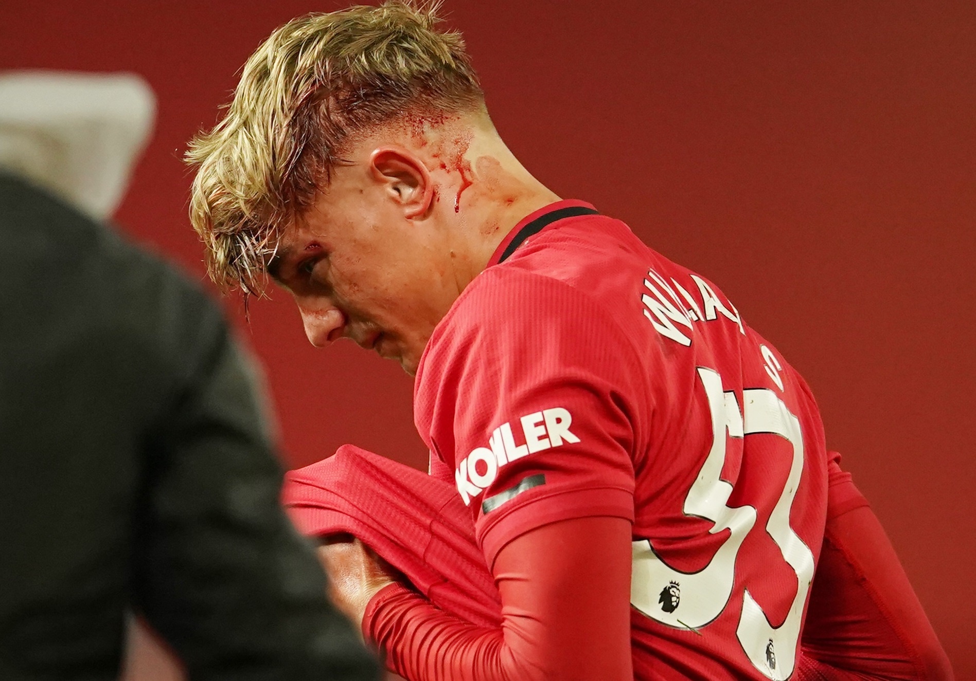 Vi sao MU phai choi thieu nguoi du moi thay 4 cau thu? hinh anh