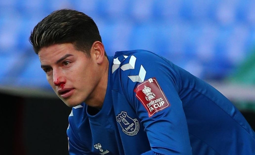 James Rodriguez do mau trong tran thang cua Everton hinh anh