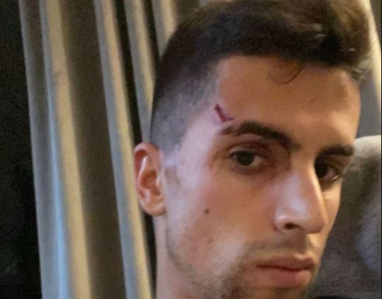 Sao Man City bi thuong khi chong tra 4 ten trom hinh anh