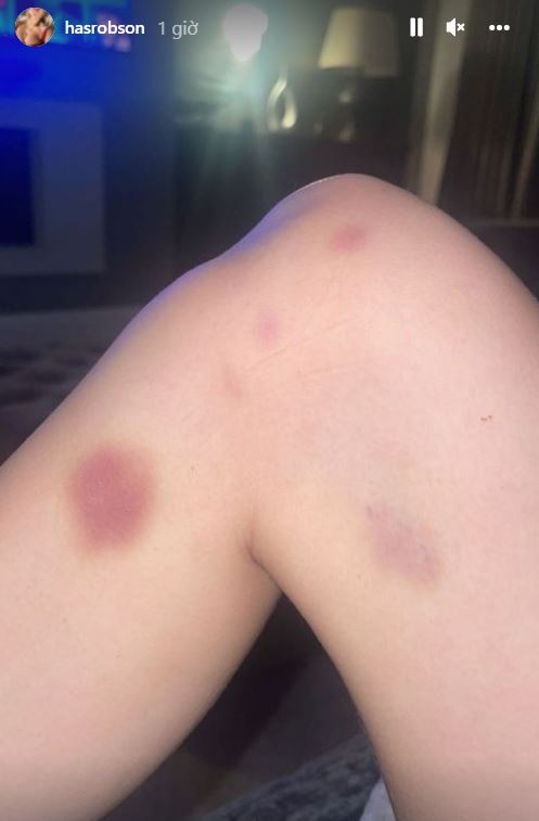 Greenwood bi to hanh hung ban gai anh 1