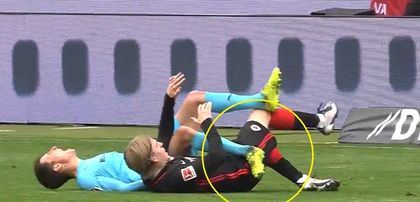 Cau thu Bundesliga gay chan anh 1