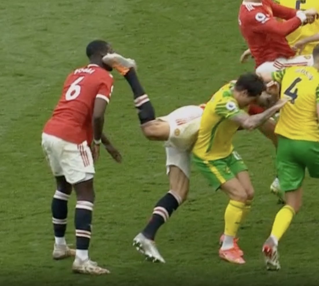 Pogba noi gian khi bi Maguire lam chay mau dau anh 1