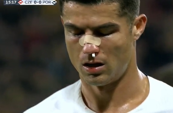 Ronaldo do mau trong tran thang CH Czech hinh anh