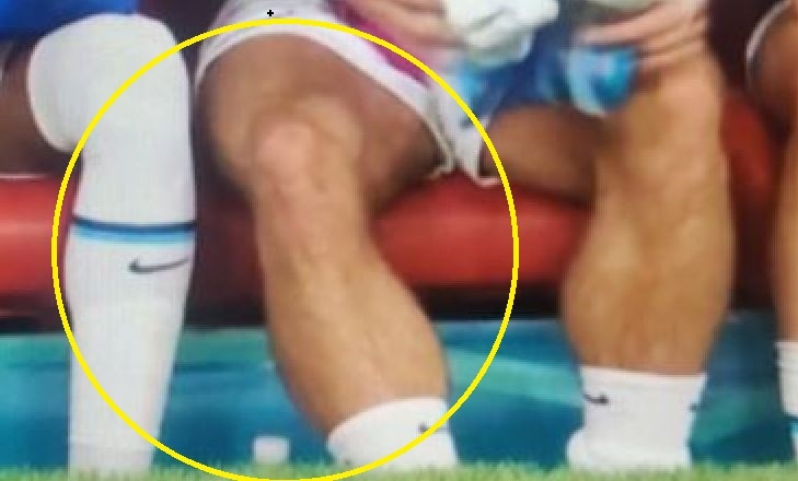 Bap chan gay chu y cua Grealish hinh anh