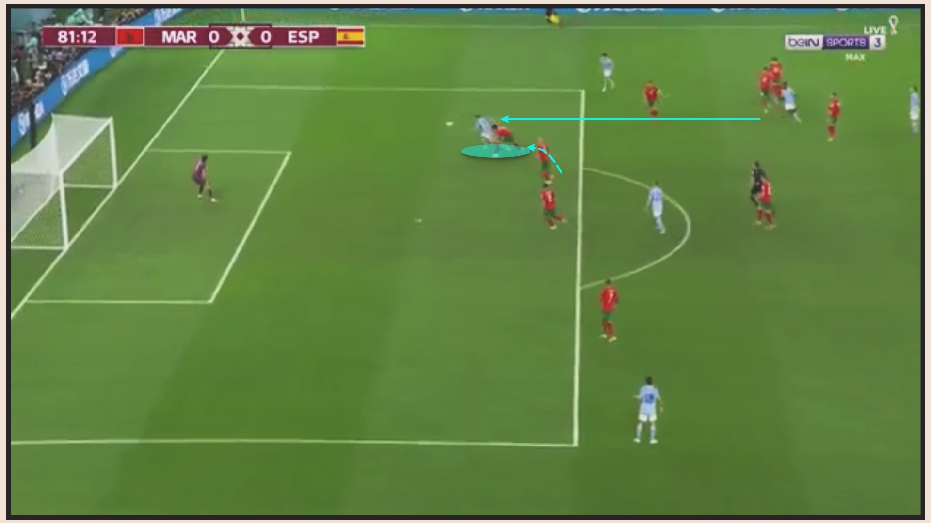 Got Achilles Tay Ban Nha anh 7