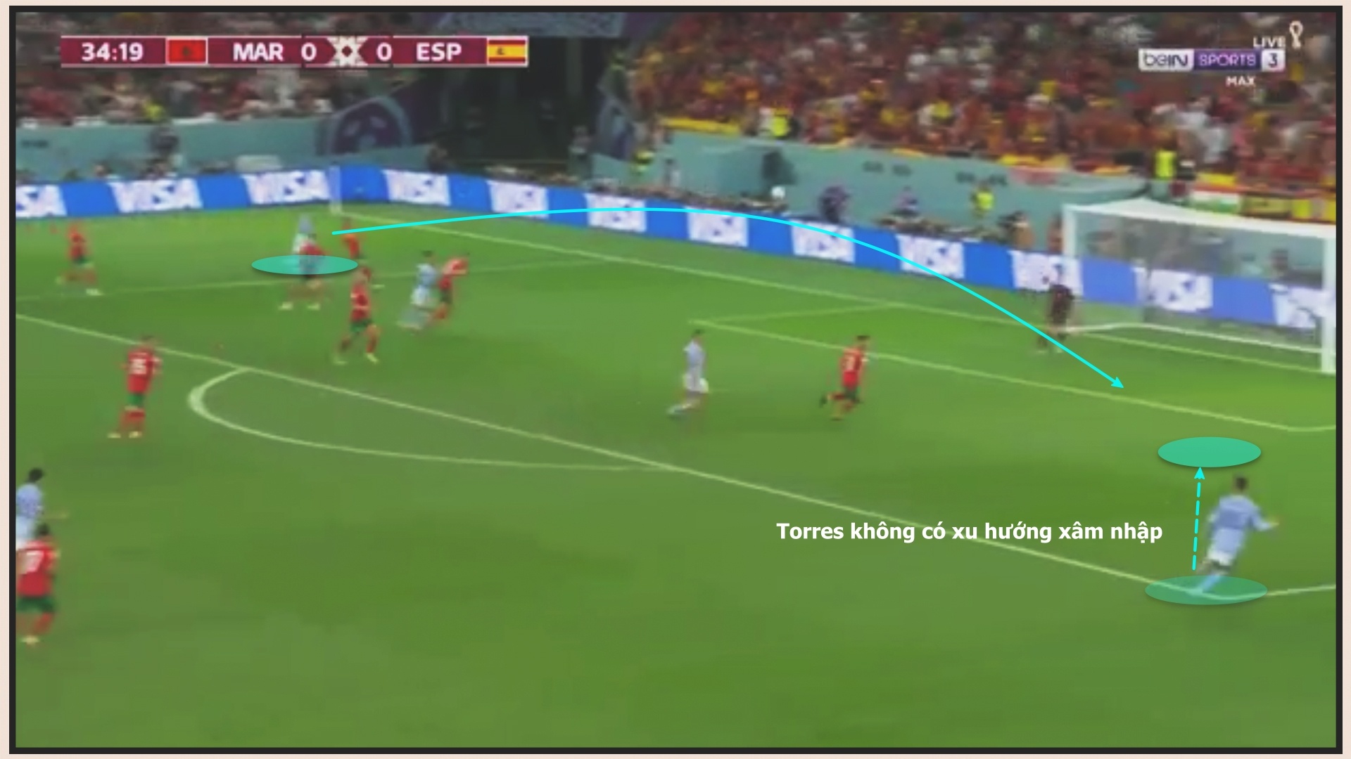 Got Achilles Tay Ban Nha anh 8