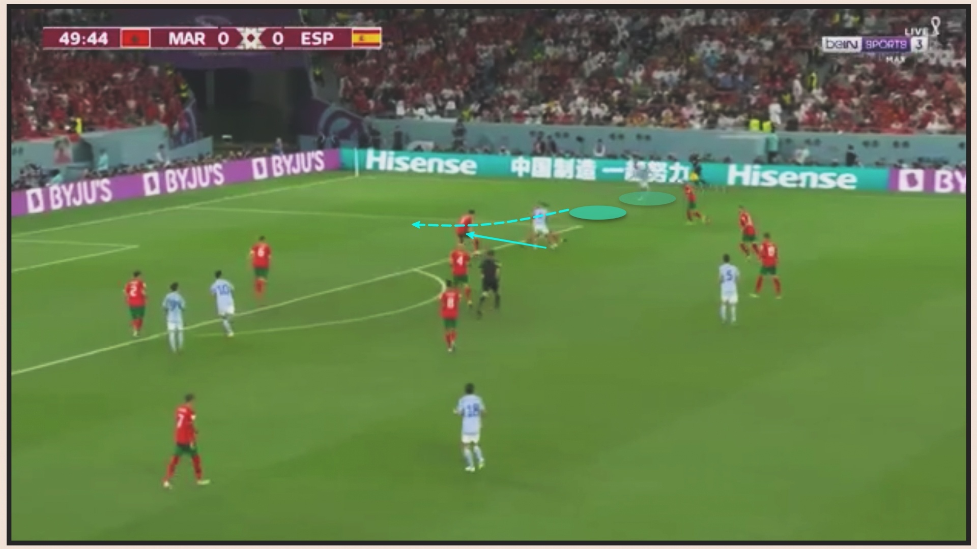 Got Achilles Tay Ban Nha anh 9