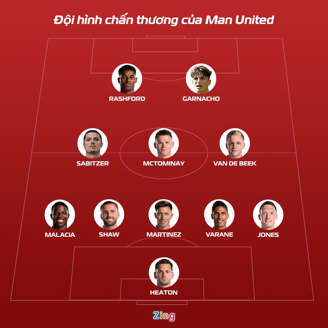 MU chan thuong anh 1