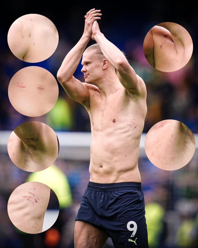 Haaland ghi ban anh 1