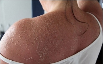 Tay trang da va nhung he luy hinh anh