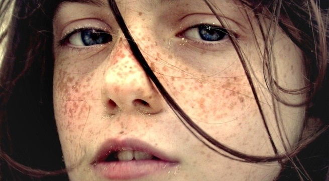 Cac lieu phap lam mo tan nhang hinh anh