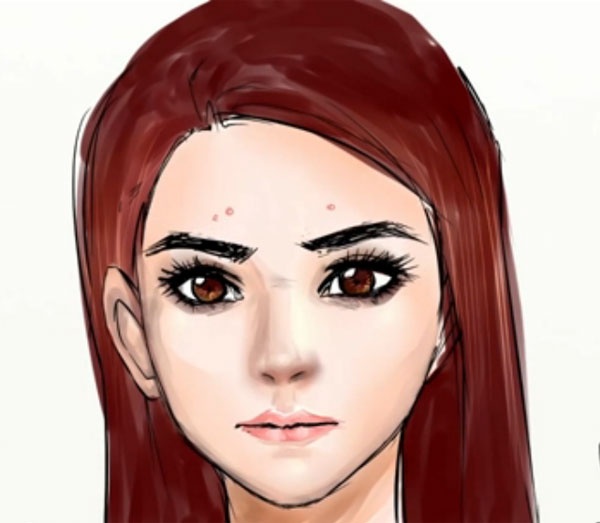 Vi tri mun tren mat canh bao gi ve suc khoe? hinh anh