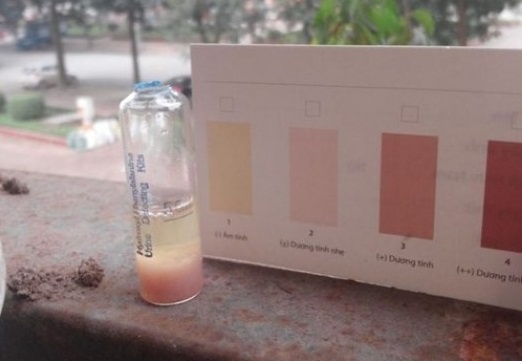 Que thu ung thu: Tien mat tat mang hinh anh