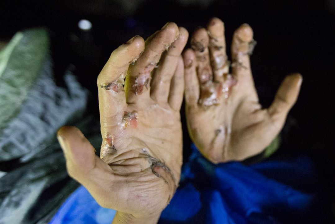 tai nan tham hiem hang Cong Nuoc anh 7