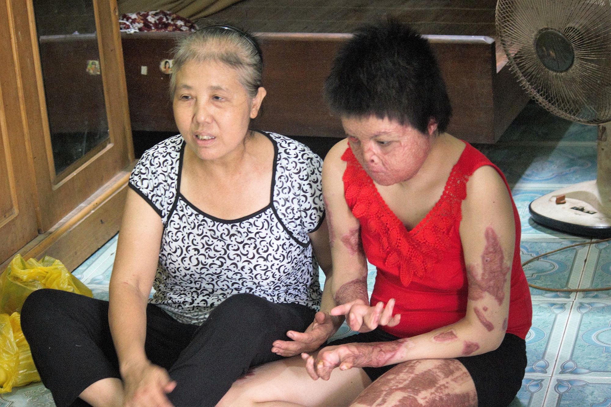 Me co gai bi chong tuoi xang dot gui thu den Bo truong Y te hinh anh