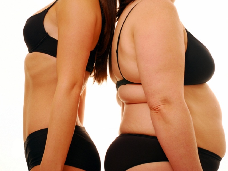 He luy cua phau thuat giam can hinh anh