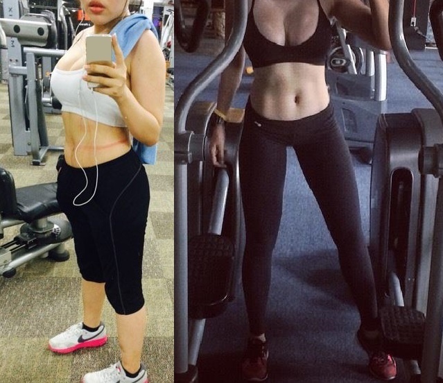 phuong phap giam mo bung anh 1