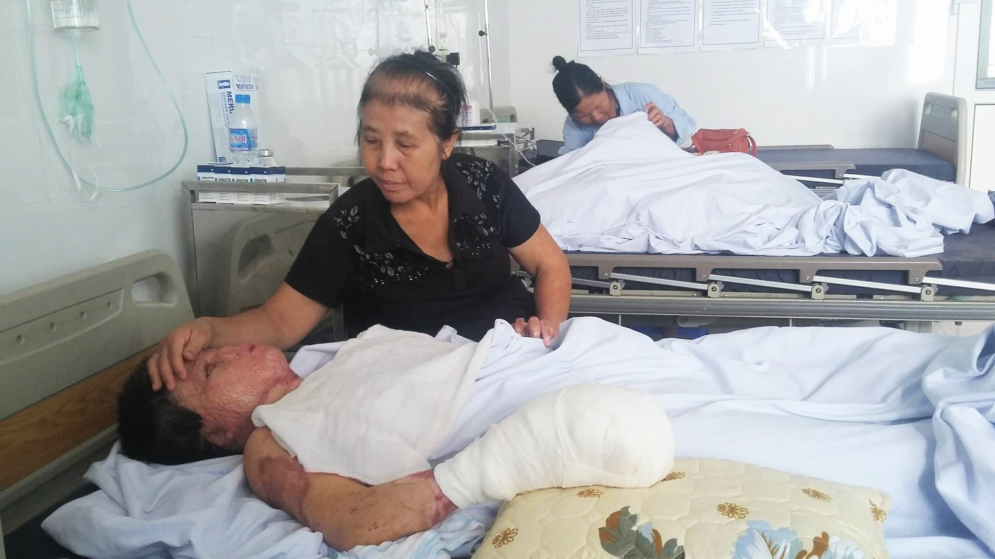 Cô gái bị chồng tưới xăng đốt,  Viện Bỏng Quốc gia ảnh 1 Co gai bi chong tuoi xang dot,  Vien Bong Quoc gia anh 1