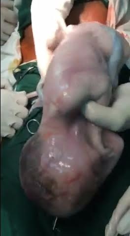 3 em be con nguyen trong boc oi anh 1