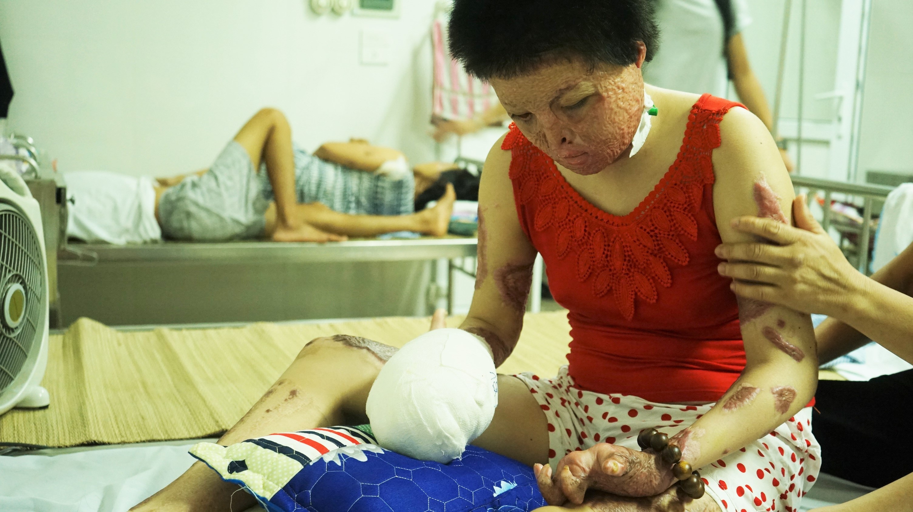 co gai bi chong tuoi xang dot anh 1