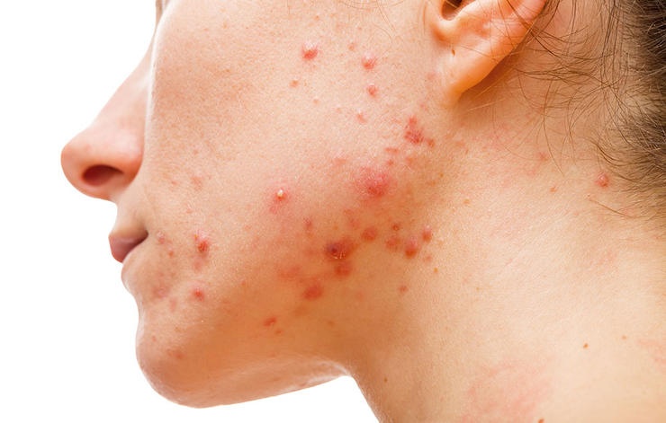 chăm sóc da ảnh 2 cham soc da anh 2