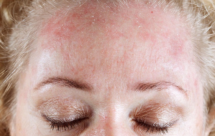 chăm sóc da ảnh 3 cham soc da anh 3