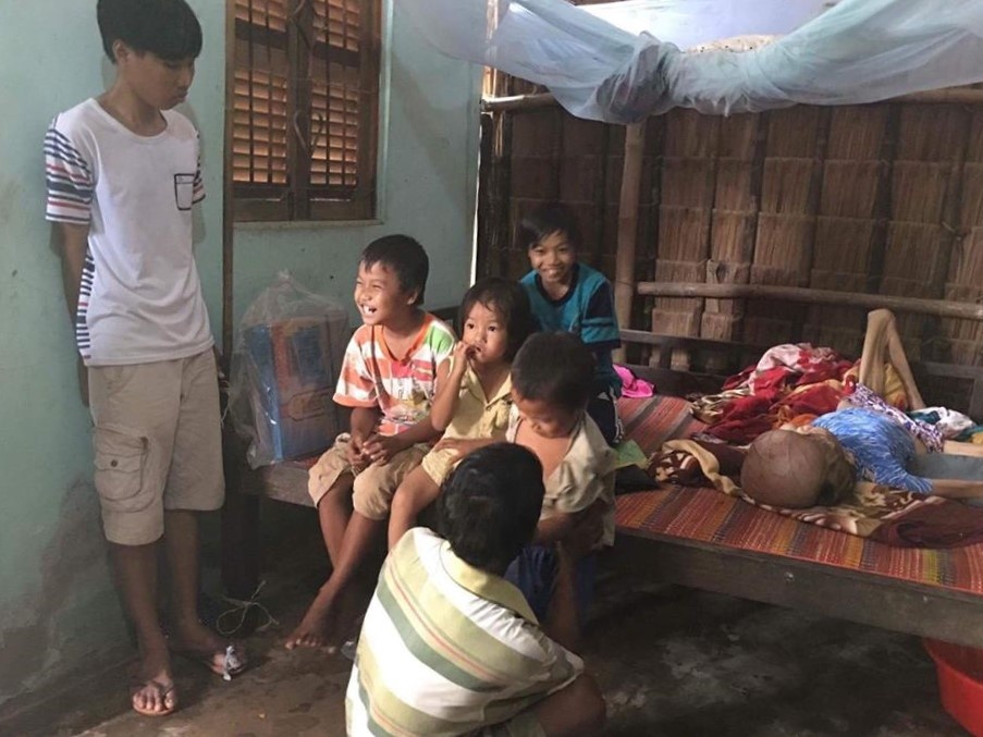 người mang khối u 4kg trên đầu ảnh 1 nguoi mang khoi u 4kg tren dau anh 1