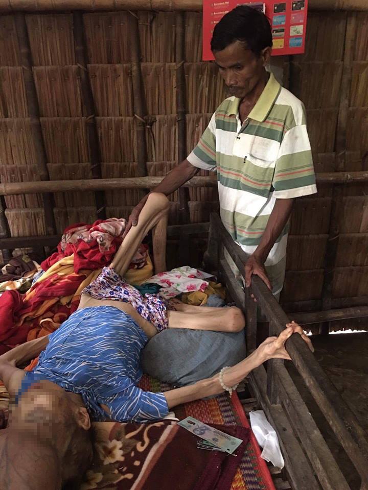 người mang khối u 4kg trên đầu ảnh 2 nguoi mang khoi u 4kg tren dau anh 2