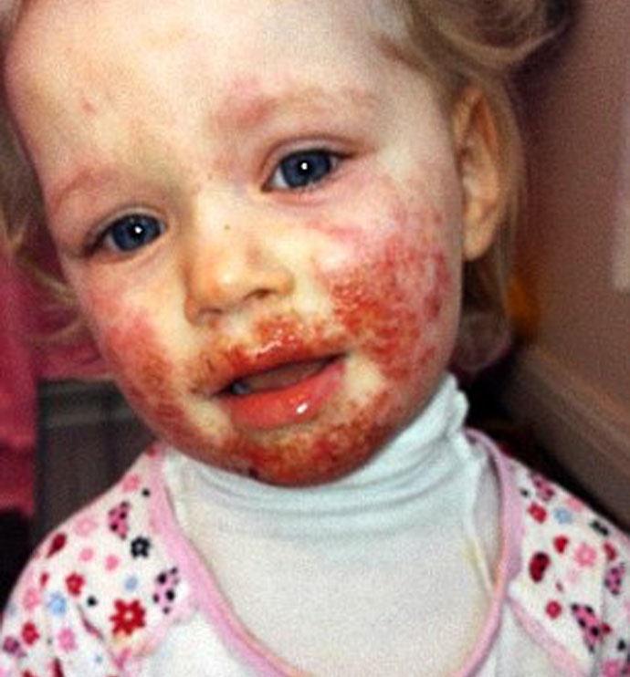 nu hon chet nguoi,  be gai bi huy hoai khuon mat anh 1