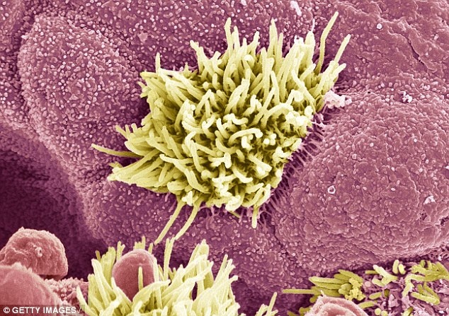 màu sắc đờm phản ánh sức khỏe con người ảnh 2 mau sac dom phan anh suc khoe con nguoi anh 2