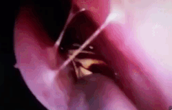 Gap con gian khoi hop so nguoi phu nu hinh anh