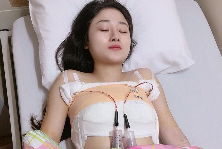 phẫu thuật nân ngực,  phẫu thuật thẩm mỹ,  nâng ngực ảnh 1 phau thuat nan nguc,  phau thuat tham my,  nang nguc anh 1