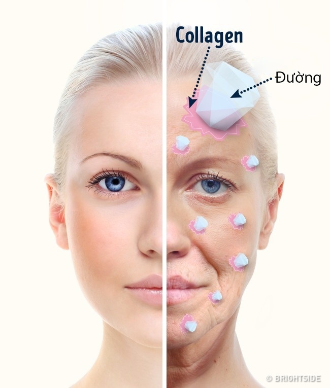 ăn nhiều đường ảnh 1 an nhieu duong anh 1