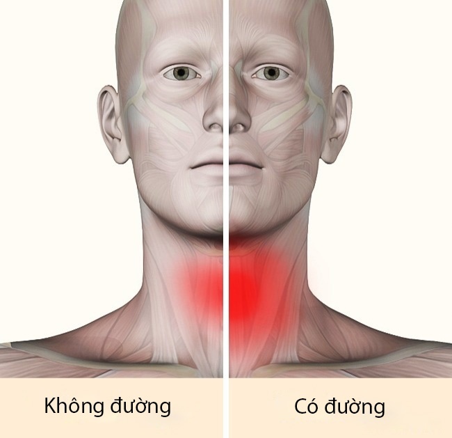 ăn nhiều đường ảnh 2 an nhieu duong anh 2