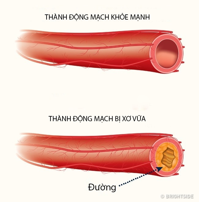 ăn nhiều đường ảnh 3 an nhieu duong anh 3