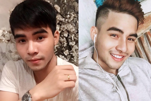 Chang trai mot nam sua mui 4 lan de so huu khuon mat lai tay hinh anh