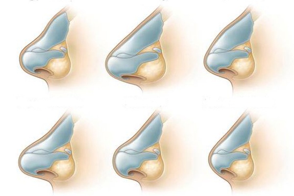 Nang mui,  nang mui bang chi anh 2