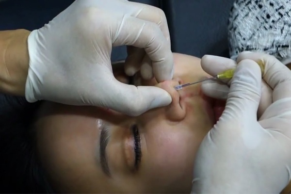 Nang mui,  nang mui bang chi anh 1