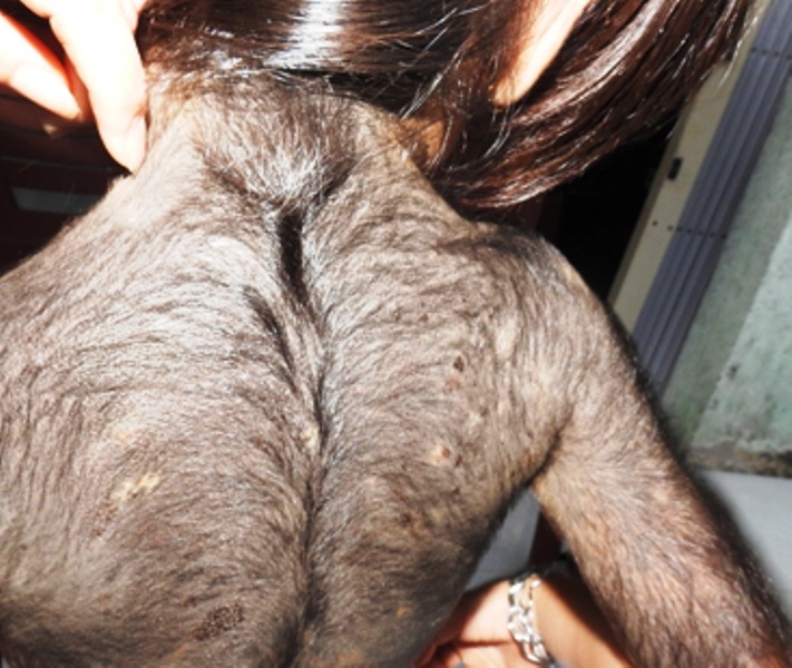 Be gai 'nguoi soi' se duoc chua benh mien phi hinh anh