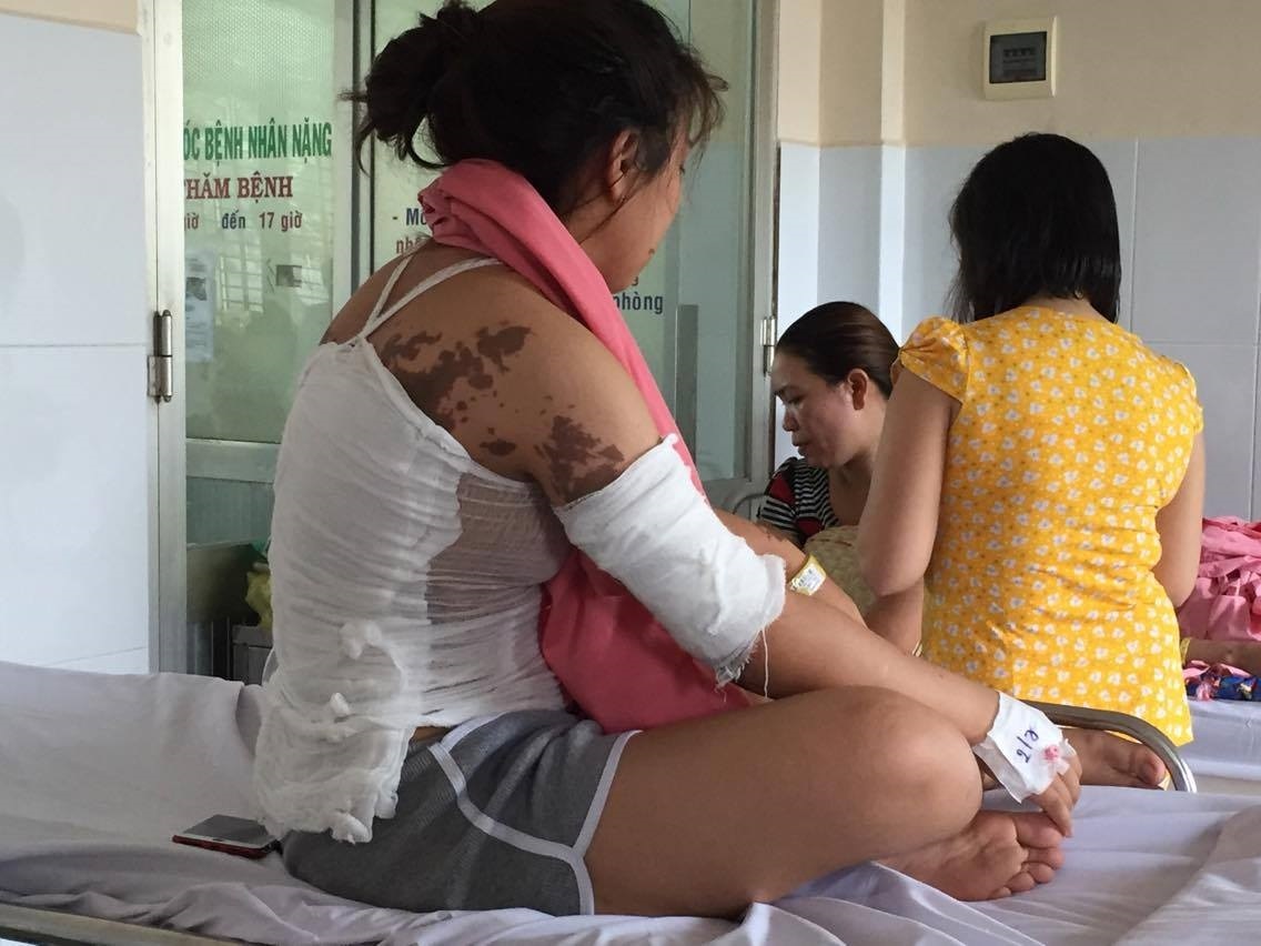 Bỏng axit  ảnh 2 Bong axit anh 2